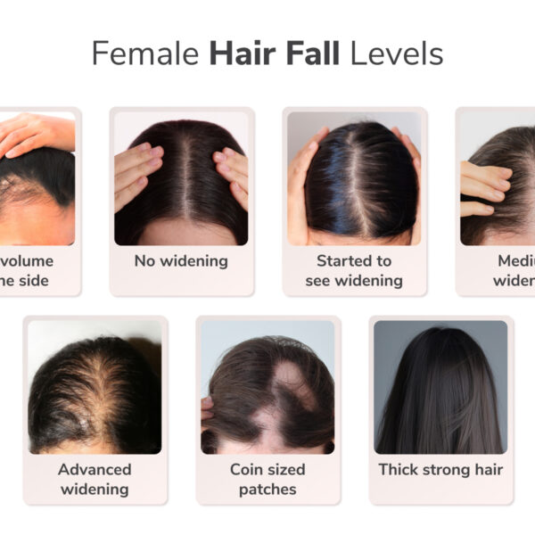 Traya study finds half of women aged 36-40 face&hellip;